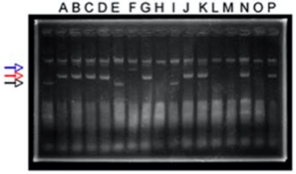 左端のレーンがコントロールのサンプルで黒矢印のバンドが空ベクターのサイズを示す。目的の断片が挿入されたプラスミドは赤矢印の位置に（レーン A–D など）、セルフダイマーは青矢印の位置に（F など）泳動された。一番上のバンドはゲノム DNA、下には RNA が観察される。